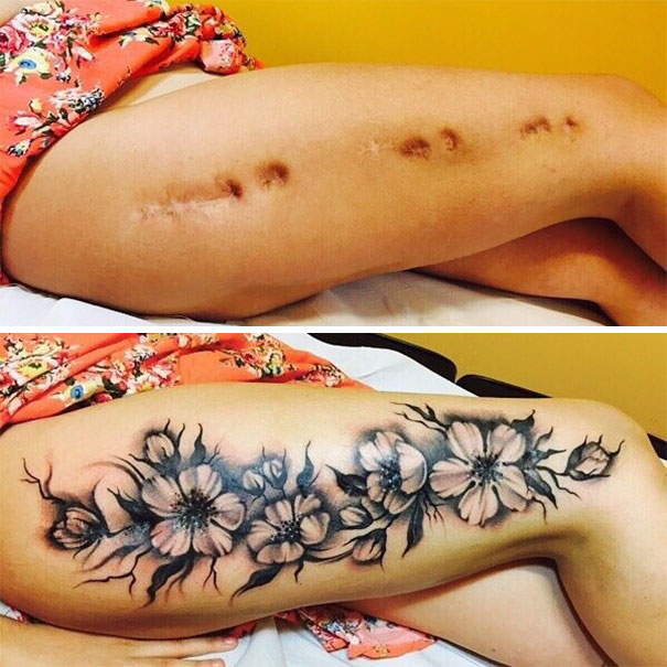 scars-tattoo-cover-up-46-590b24604a6a5__605